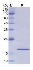 SDS-PAGE (KRT17-4392H).jpg